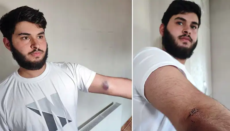 Bahçeye Kaçan Top Mahallede Kargaşaya Neden Oldu